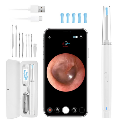 1080P Waterproof Ear Endoscope