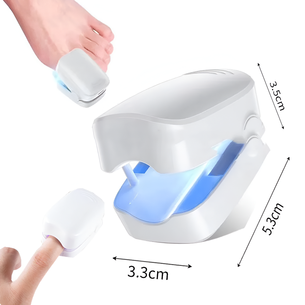 UV Nail Fungus Laser Treatment