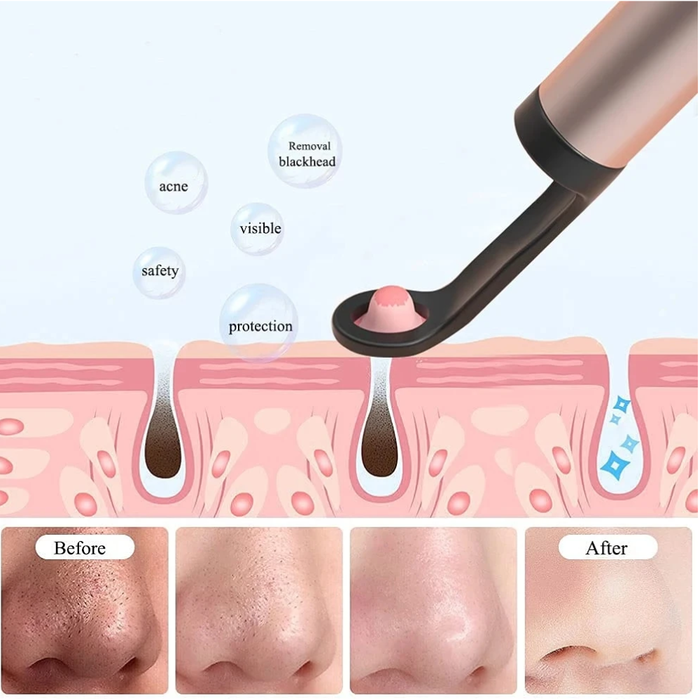 1080P Waterproof Ear Endoscope
