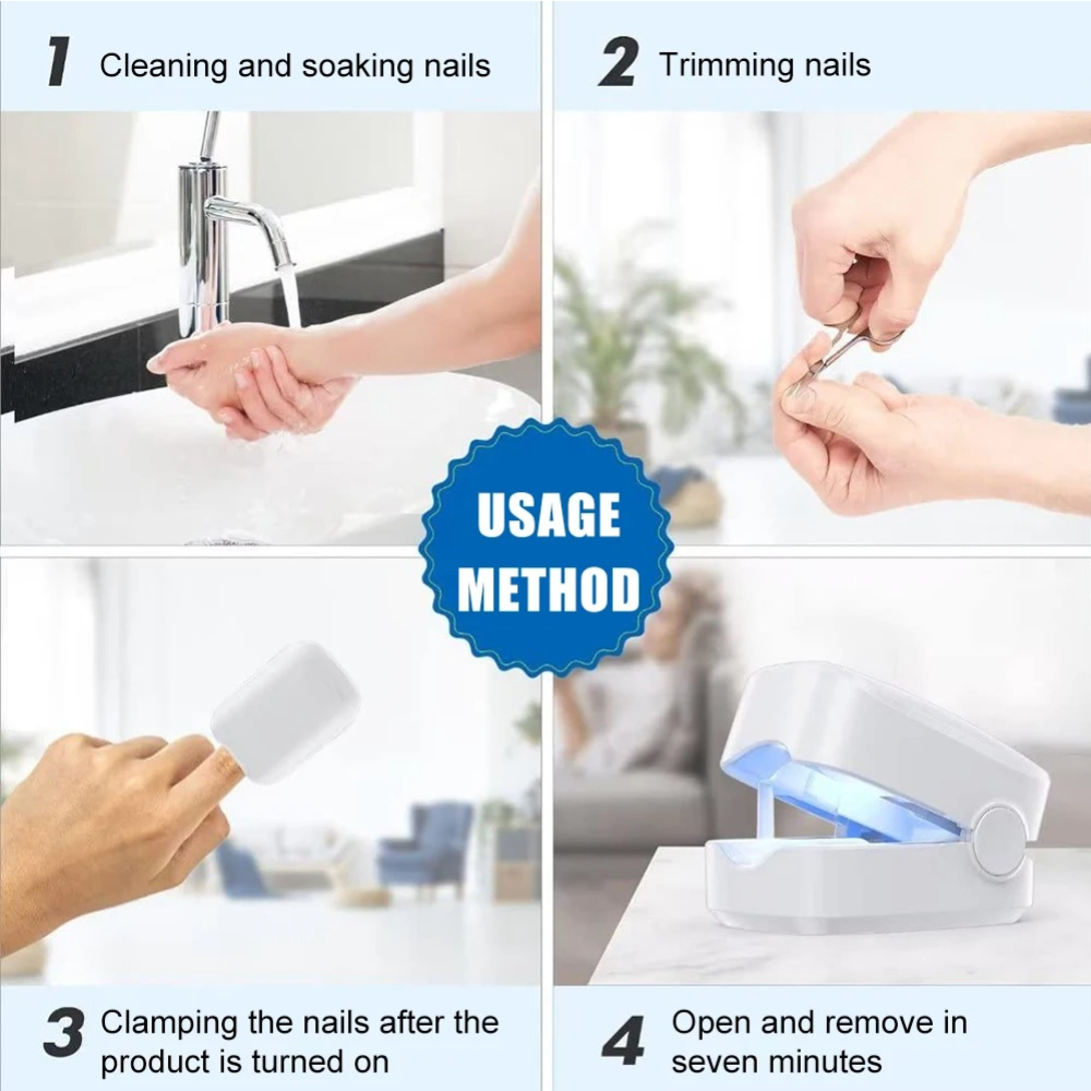 UV Nail Fungus Laser Treatment